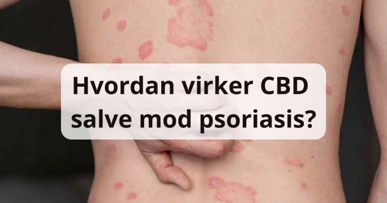 Hvordan virker CBD salve mod psoriasis?